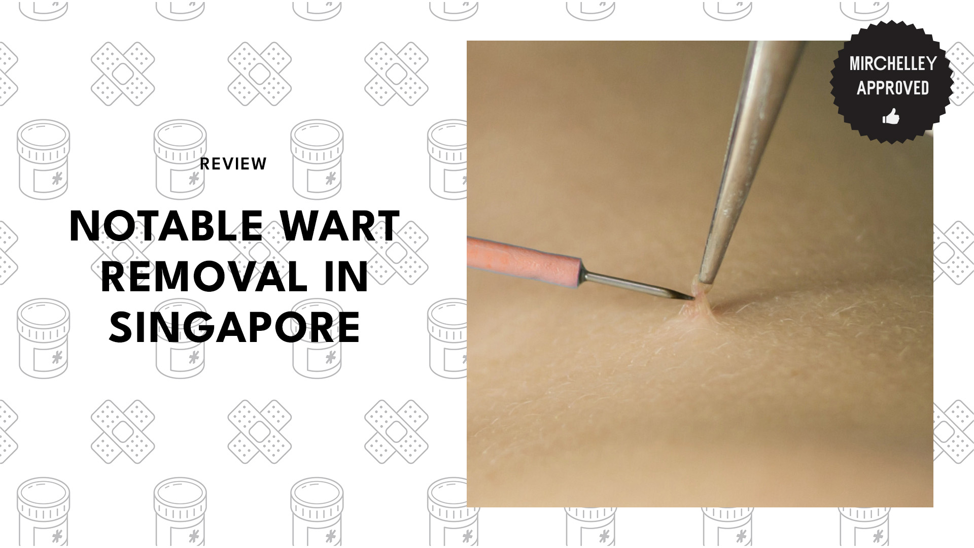 top-wart-removal-singapore-banner